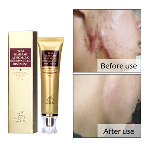 Ginseng Essence Scar Removal cream